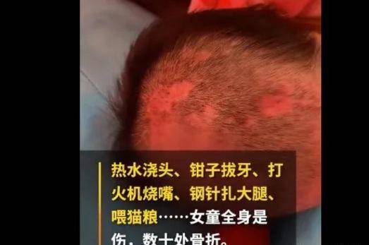 虐童事件背后：受虐的孩子们该如何面对早已残破的世界<strong></p>
<p>残破币</strong>！