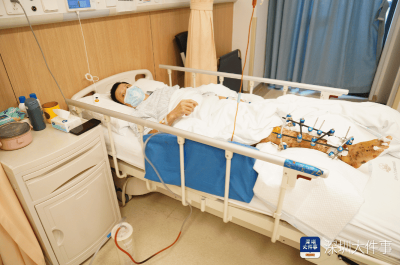 失血过半！深圳男子被三四百斤模具砸到<strong></p>
<p>广州货币交易市场</strong>，医生全力抢救