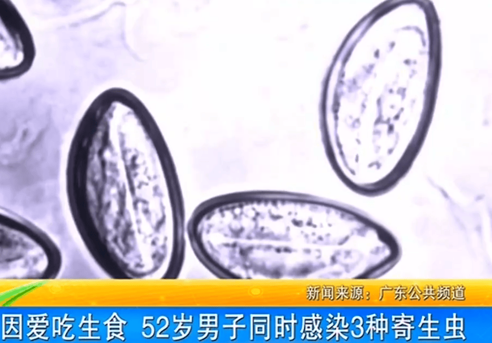 女子体内排出10米长绦虫<strong></p>
<p>镑日货币对交易系统</strong>！原是两年前旅游时吃了这种食物