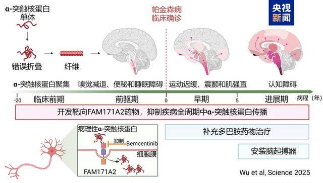 全球首次<strong></p>
<p>basecoin币</strong>！复旦大学科研团队发现帕金森病全新治疗靶点