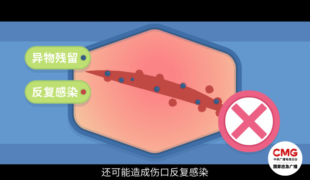 洗澡时突然爆炸<strong></p>
<p>如何做空货币</strong>，女子手筋断裂，多处缝针……家里有它快自查