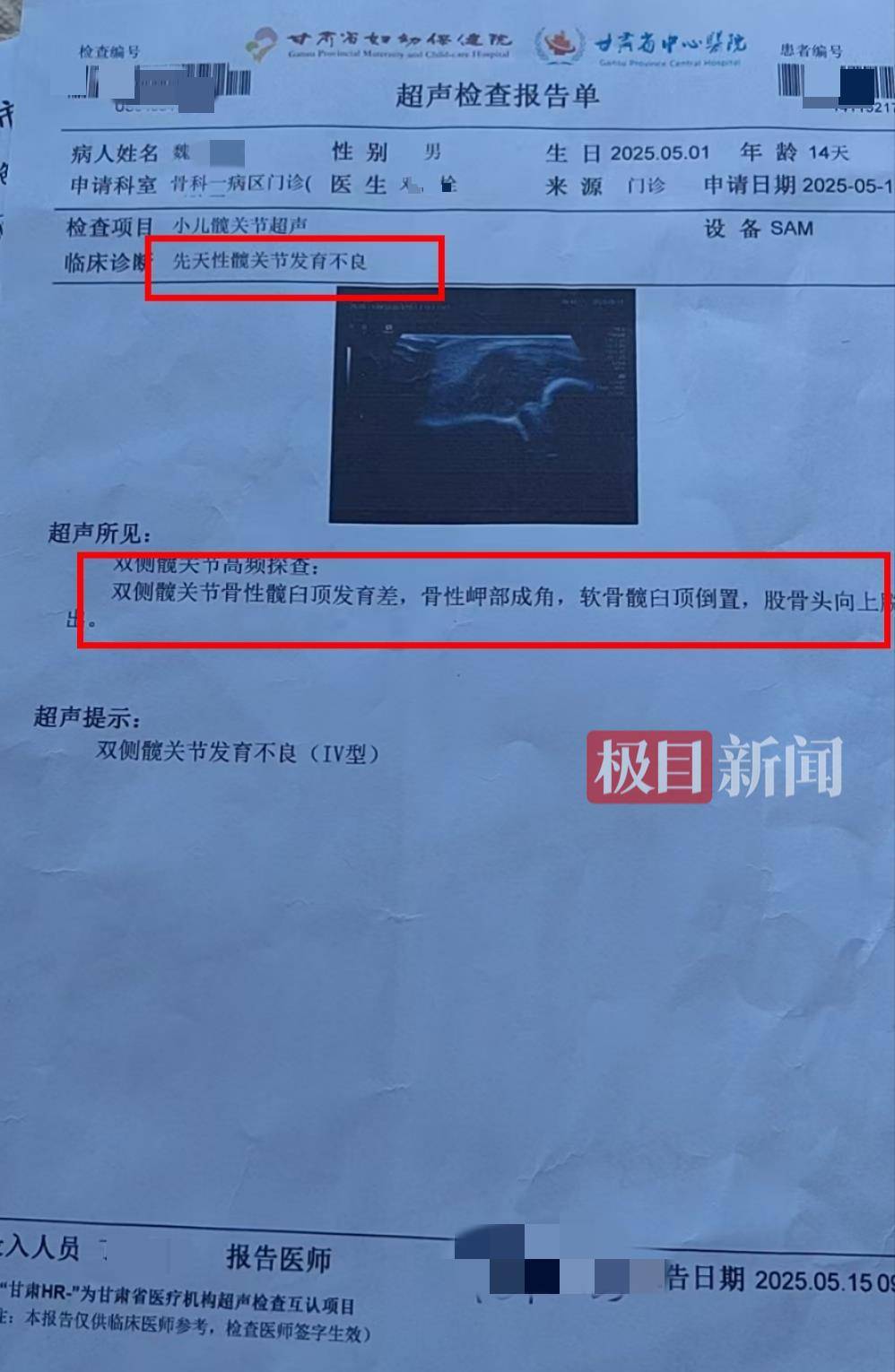 二胎出生查出先天性病症或落下残疾<strong></p>
<p>抖币怎么用</strong>，残疾父母称医院产检漏检、未尽告知义务，医院及医调委回应