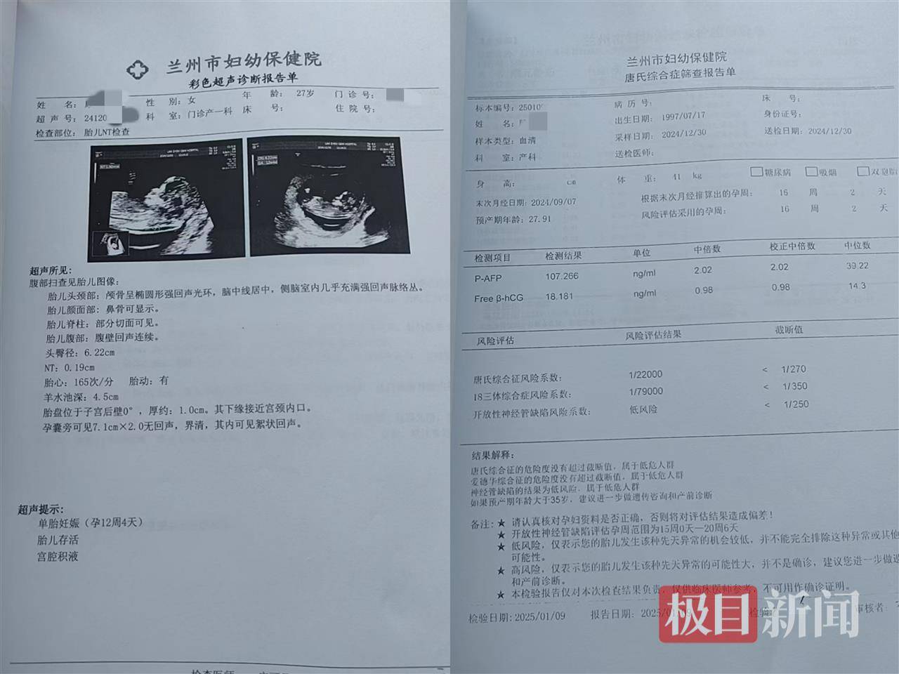 二胎出生查出先天性病症或落下残疾<strong></p>
<p>抖币怎么用</strong>，残疾父母称医院产检漏检、未尽告知义务，医院及医调委回应