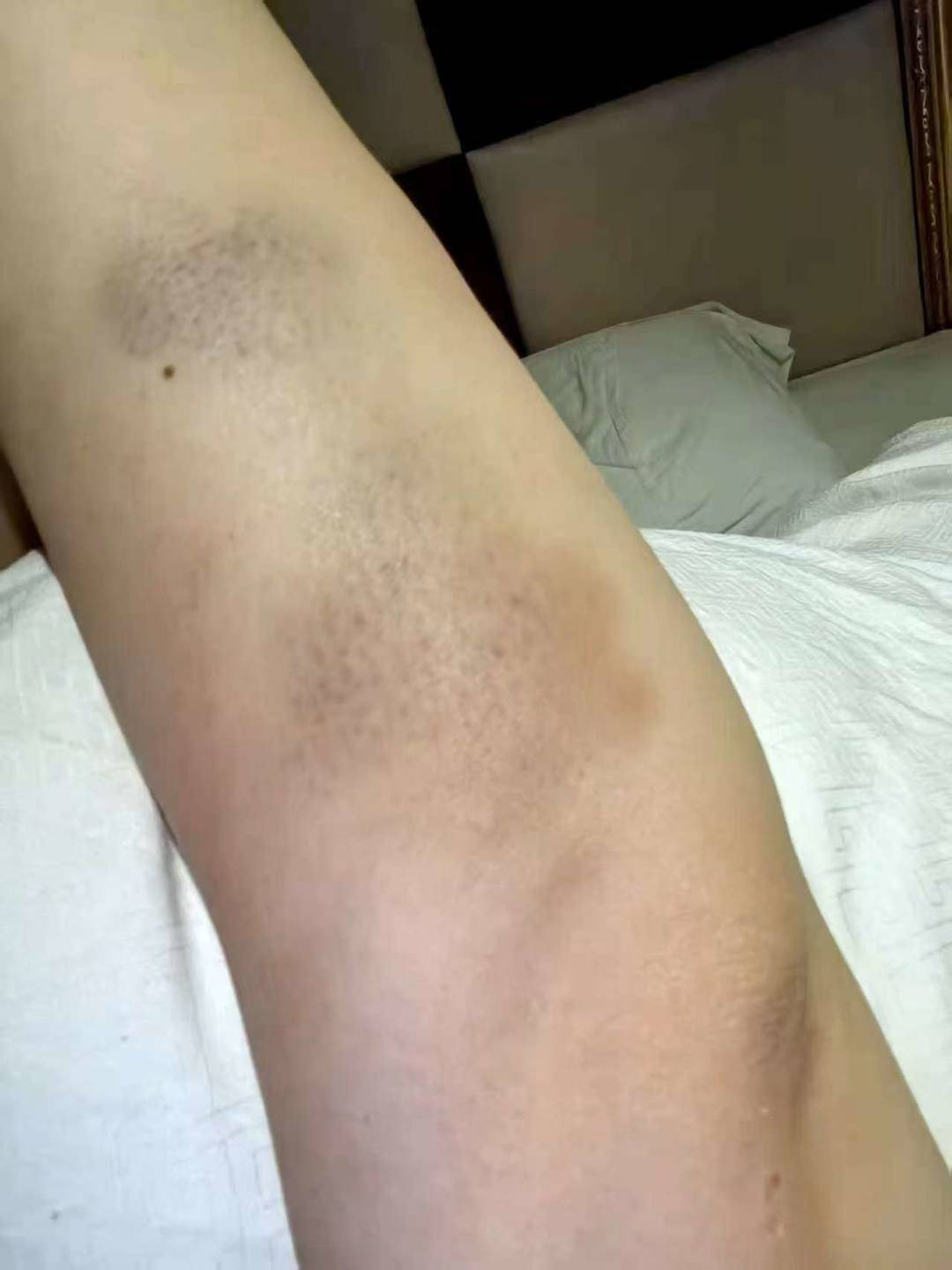 毒杀儿女的父亲：夫妻婚后经济压力较大<strong></p>
<p>波场币怎么买</strong>，案发前曾达成离婚协议｜封面深镜