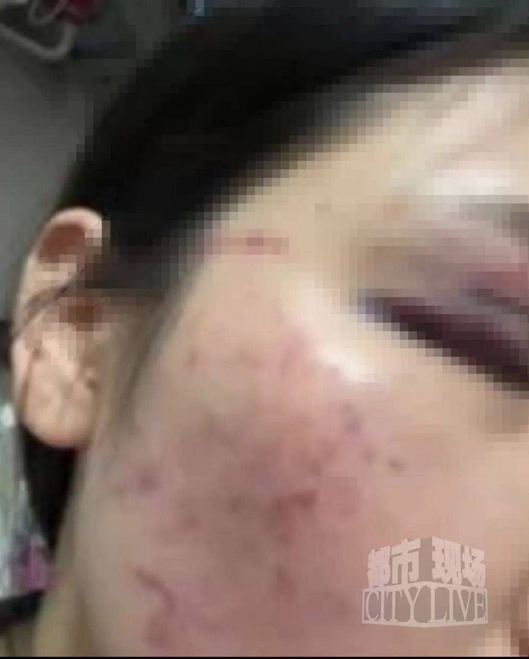 湖南衡阳29岁女子疑被男友施暴后从25楼跳下身亡 男友徐某此前还刺激说：“你放心<strong></p>
<p>以太坊美元价格</strong>，她不会去死的”