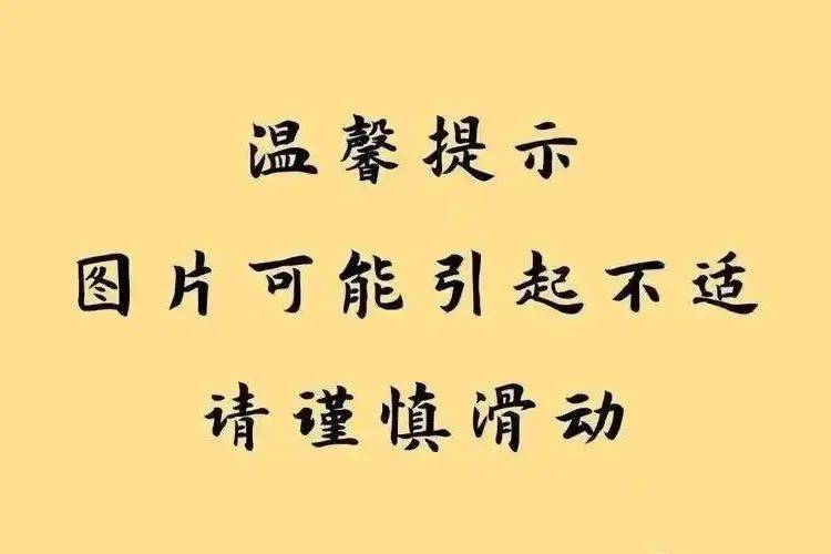 一旦接触<strong></p>
<p>以太坊美元</strong>，10秒即可感染！汛期谨防这种病→