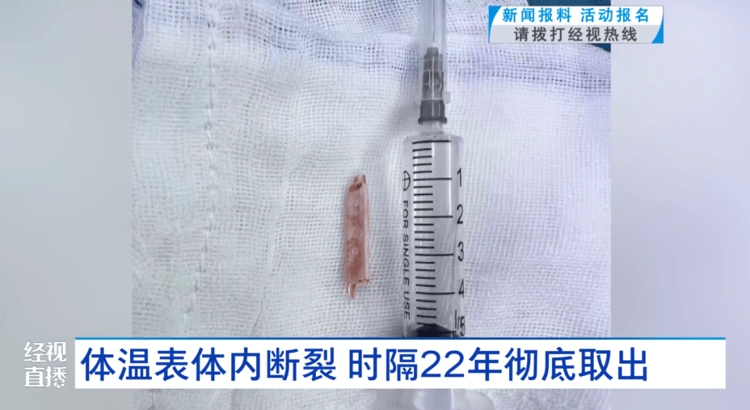 体温表在体内断裂<strong></p>
<p>以太坊最新</strong>，女子时隔22年彻底取出！医生：庆幸水银不在里面