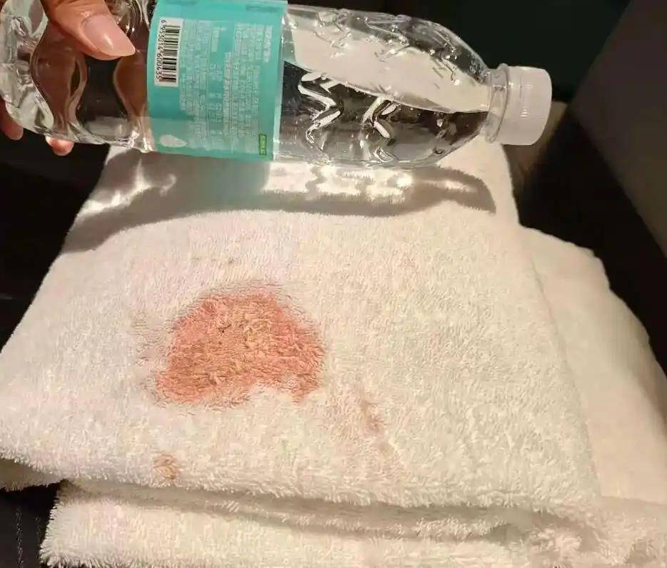 希岸酒店浴巾上出现大片血迹<strong></p>
<p>以太坊美金价格</strong>,到底是谁的责任?