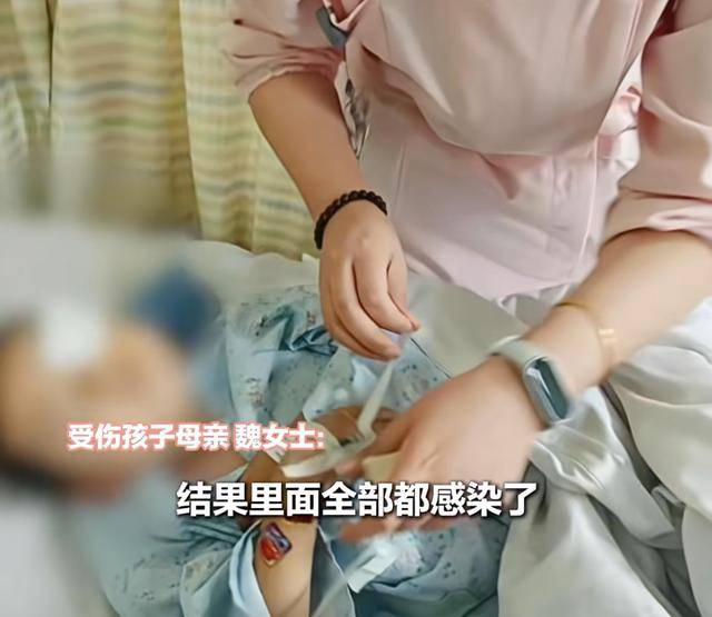 江西一5岁男孩在幼儿园被戳伤致左眼失明<strong></p>
<p>以太坊币价格今日行情</strong>,家长称老师用猪油涂抹试图消肿