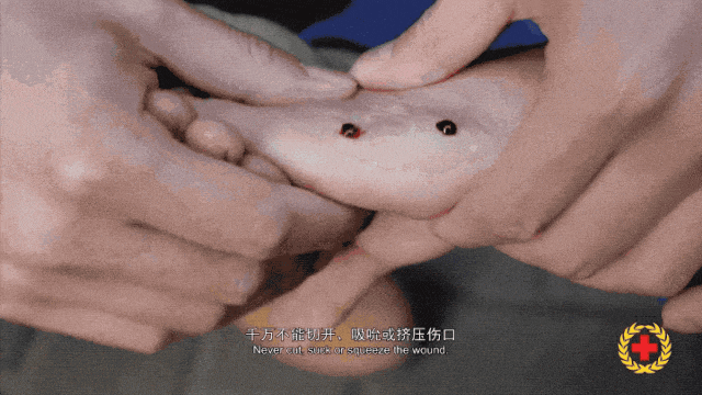 女子半夜上厕所<strong></p>
<p>以太坊手续费</strong>，马桶里突然窜出一条蛇！